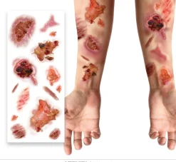 Plaktattoos Geinfecteerde wonden